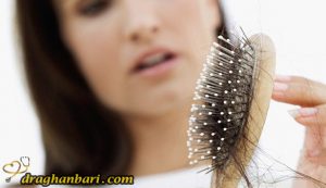 ریزش مو در خانمها و روش درمان آن
